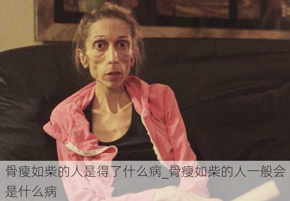 骨瘦如柴的人是得了什么病_骨瘦如柴的人一般会是什么病