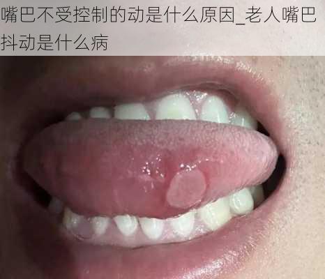 嘴巴不受控制的动是什么原因_老人嘴巴抖动是什么病