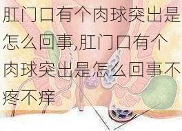 肛门口有个肉球突出是怎么回事,肛门口有个肉球突出是怎么回事不疼不痒